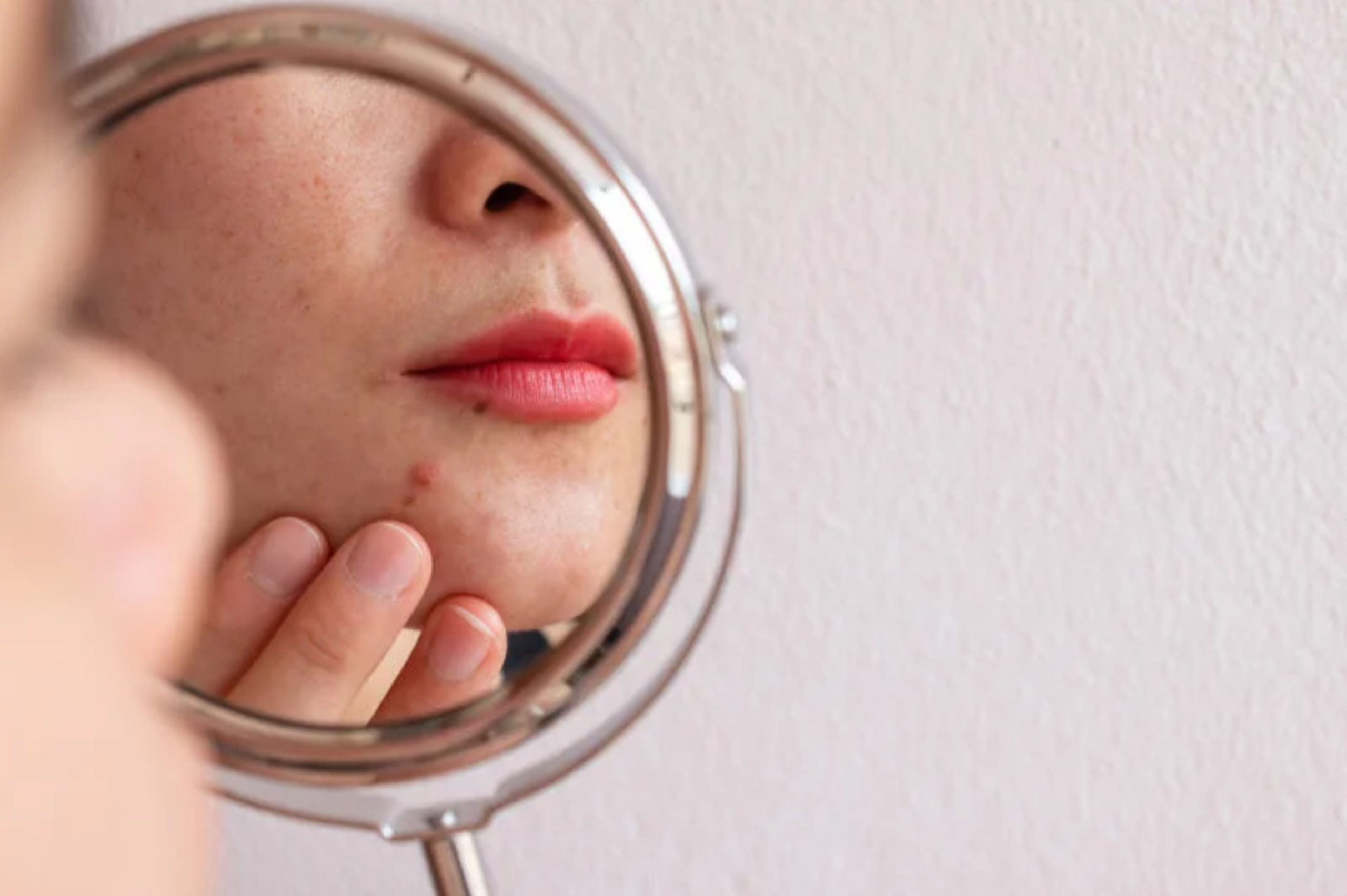 Monsoon Skin Problems and How to Prevent Them