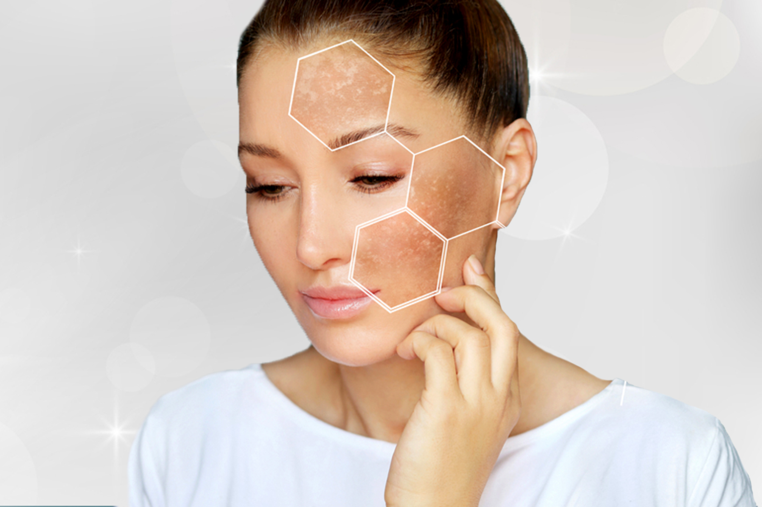 Why You Should Never Self-Treat Pigmentation Without a Dermatologist