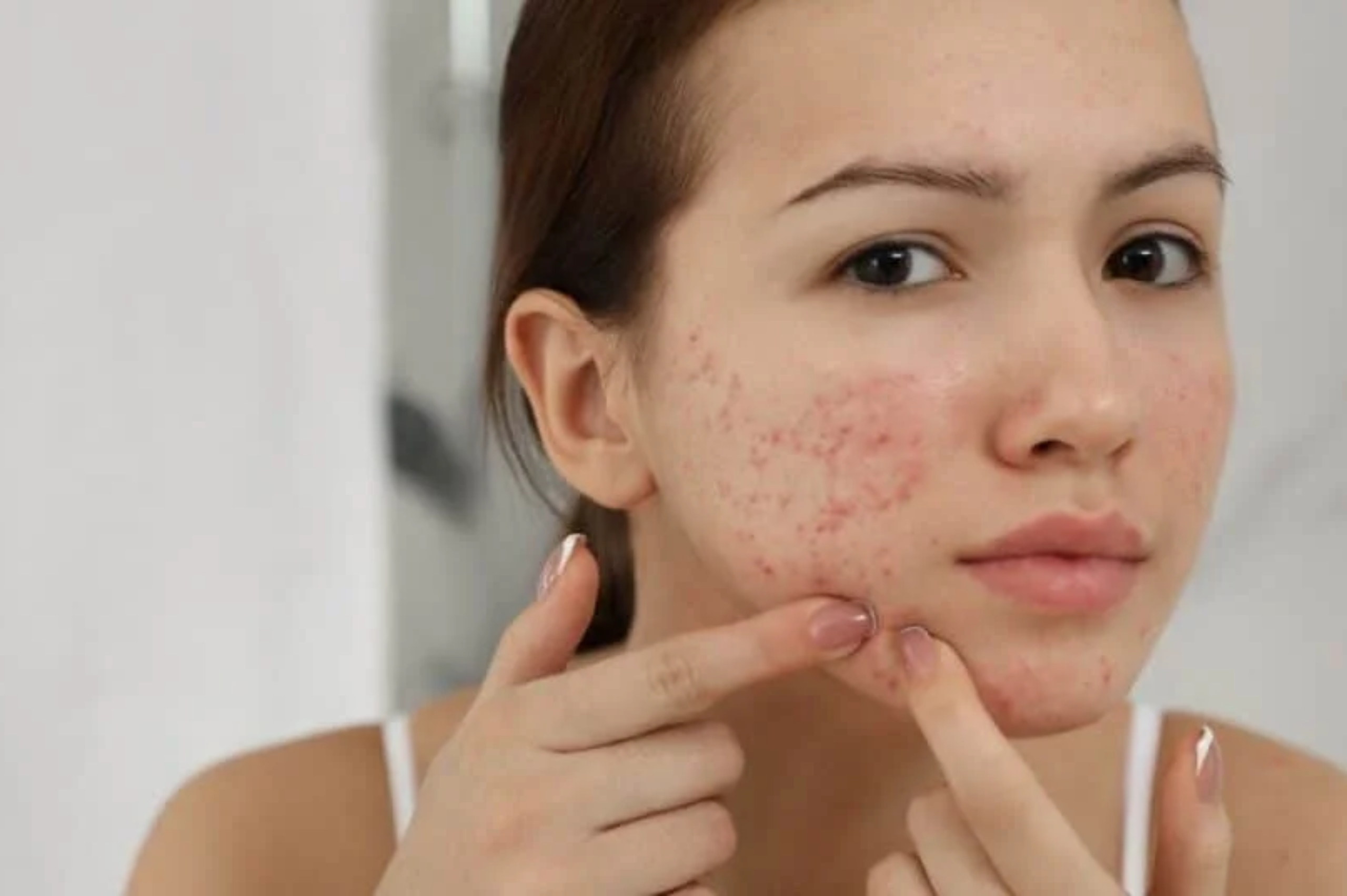 Monsoon Skin Problems Dermatologists See Most Often