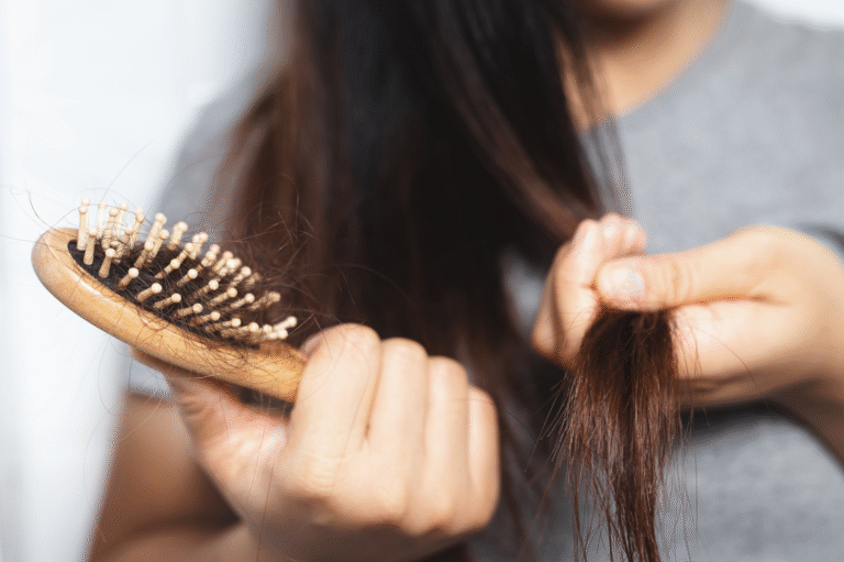 Why Hair Loss Needs a Dermatologist’s Attention – Not Just Home Remedies