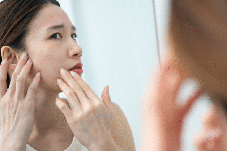 Best Treatments for Large Pores