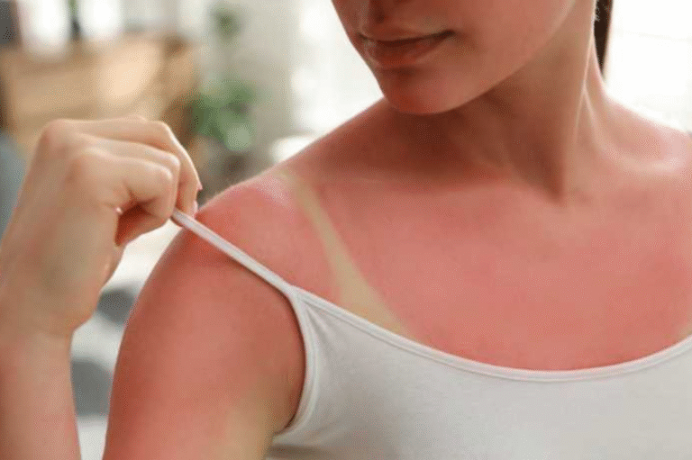 Tan Removal Treatments That Actually Work-Dermatologist Guide